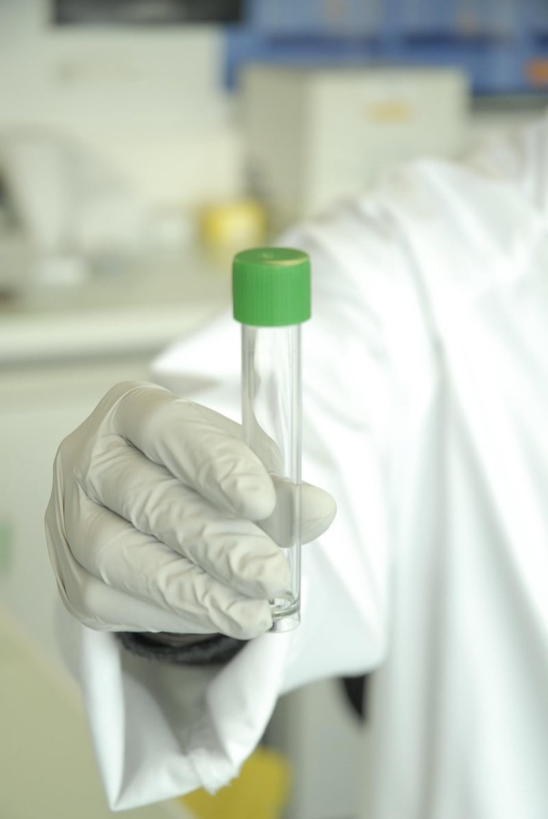 Exotic Matter Extraction